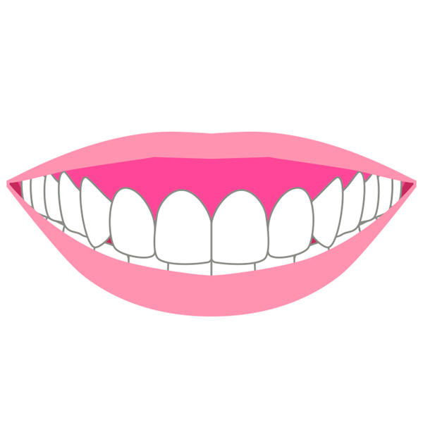 ガミースマイルでお悩みの方