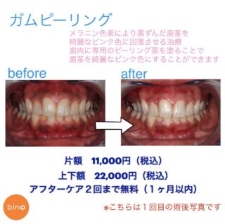 口腔外科 インプラント 台東区御徒町の歯医者 ビーノ御徒町歯科クリニック です